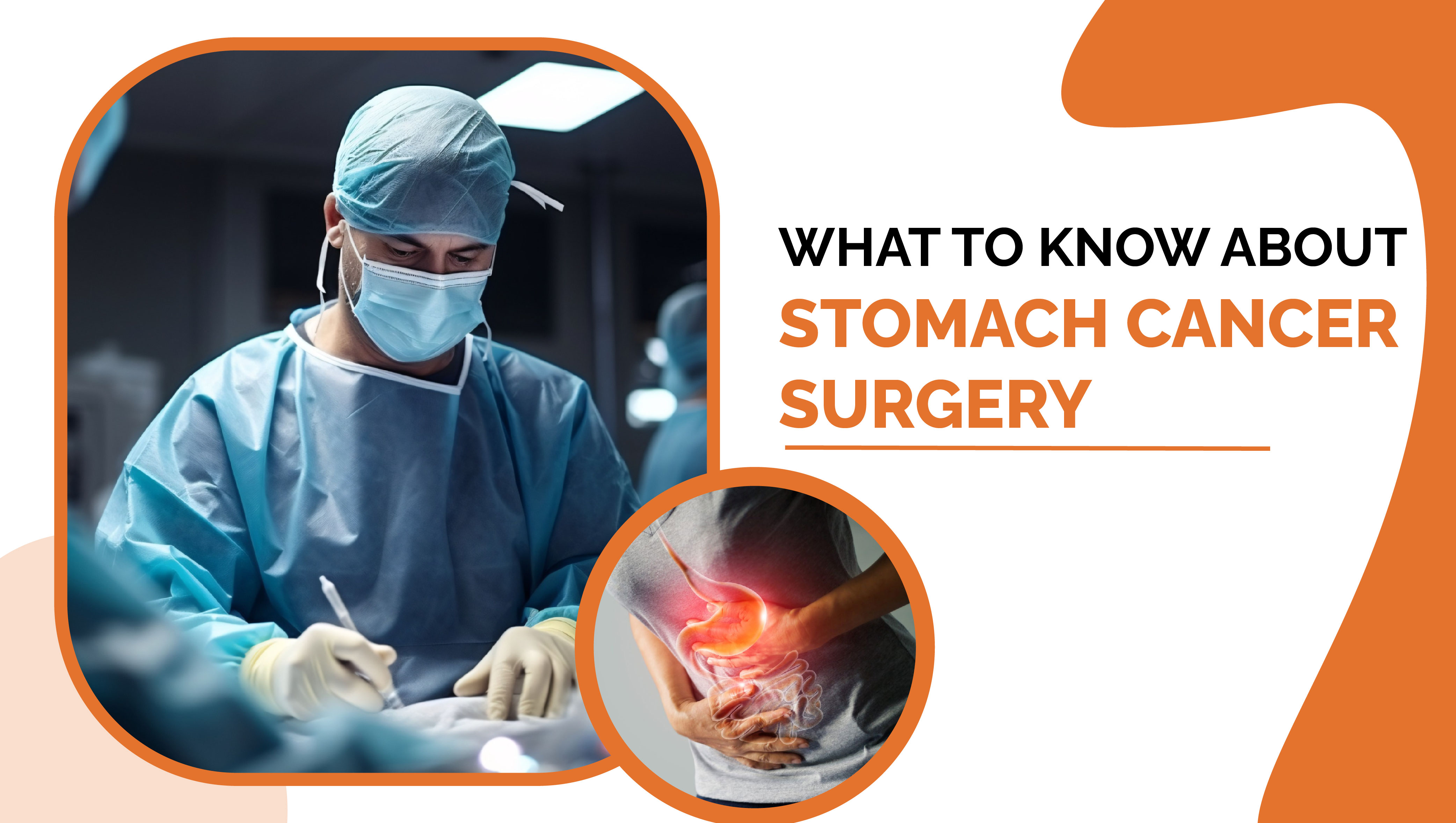 What to Know About Stomach Cancer Surgery