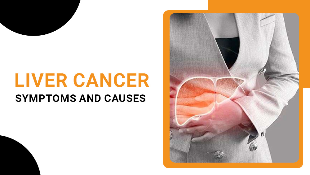 Liver Cancer – Symptoms and Causes
