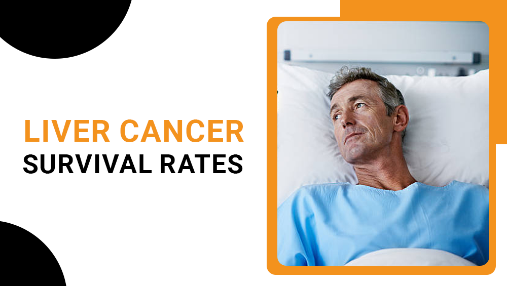 Liver Cancer Survival Rates