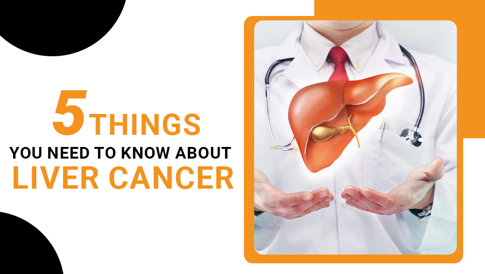 5 Things You Need to Know About Liver Cancer