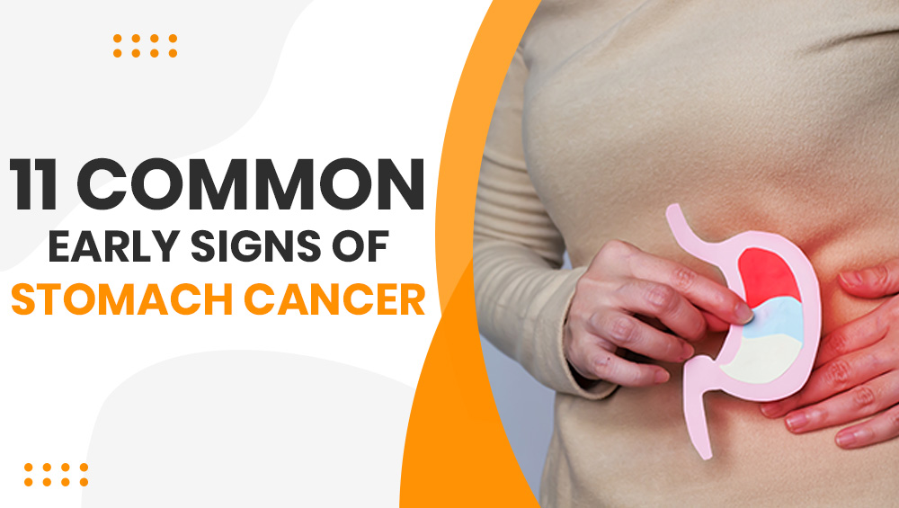 11 Common Early Signs of Stomach Cancer