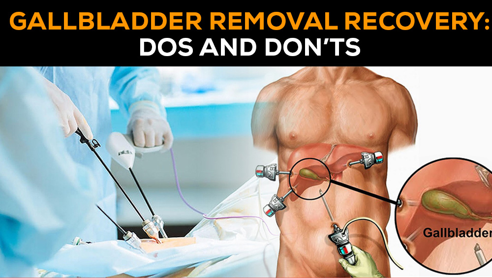 Gallbladder Removal Recovery: Do’s and Don’ts