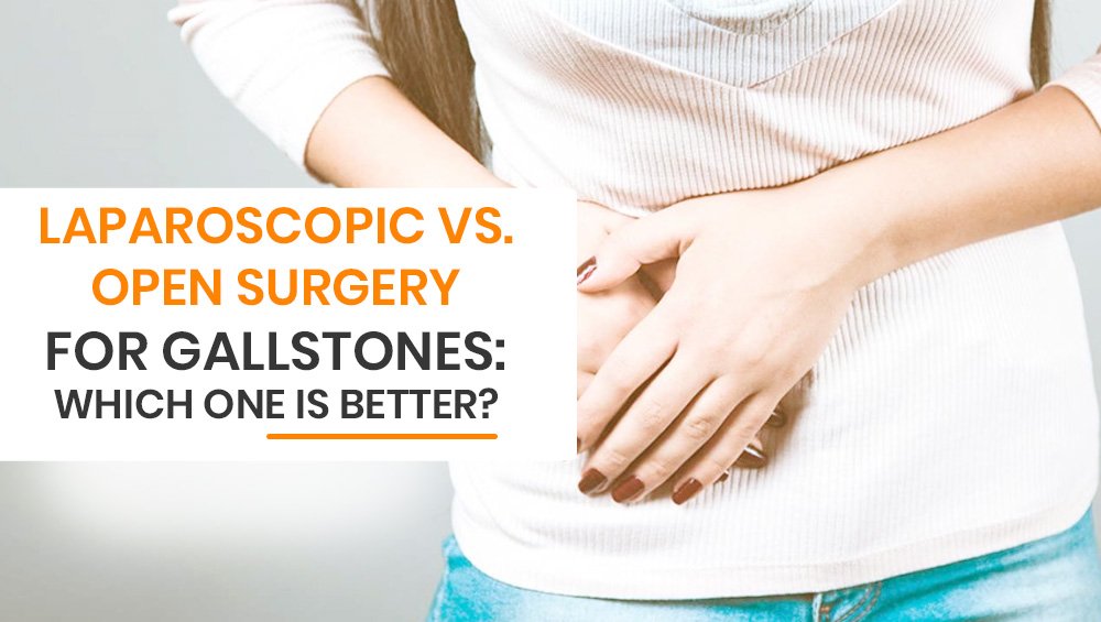Laparoscopic vs. Open Surgery for Gallstones: Which One Is Better?