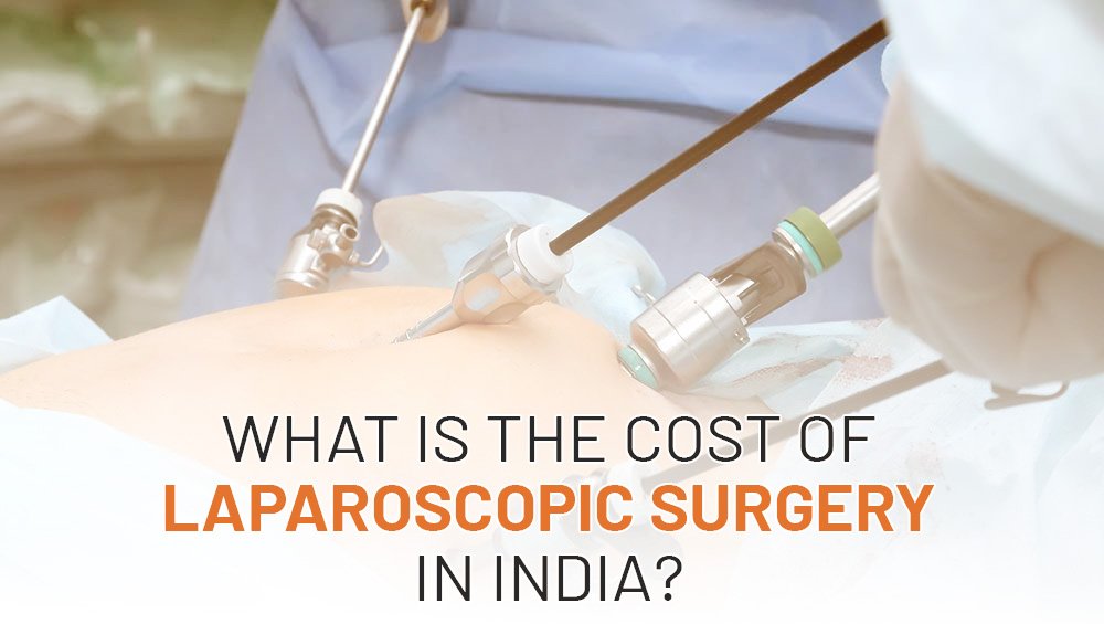What is the Cost of Laparoscopic Surgery in India?