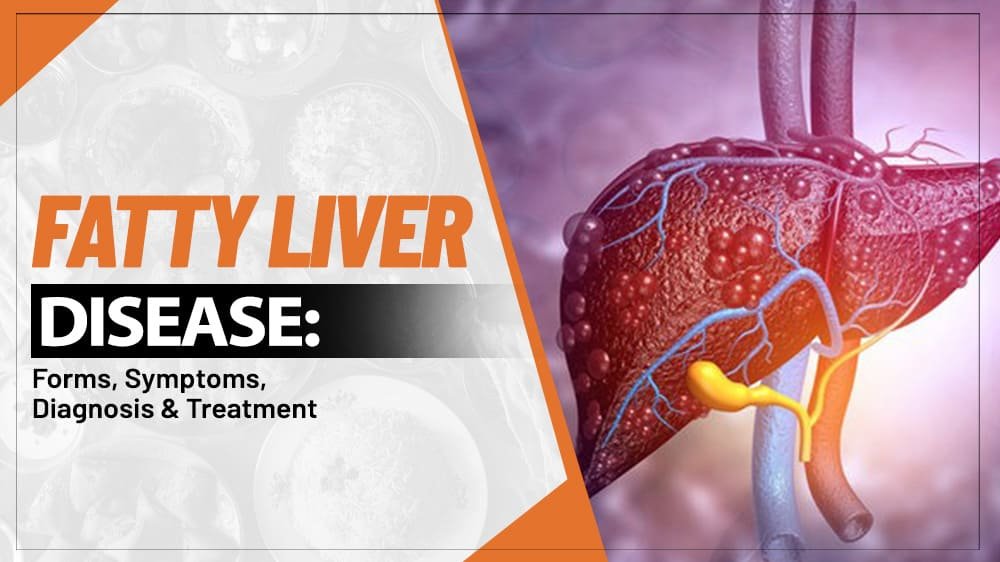Fatty Liver Disease: Forms, Symptoms, Diagnosis & Treatment