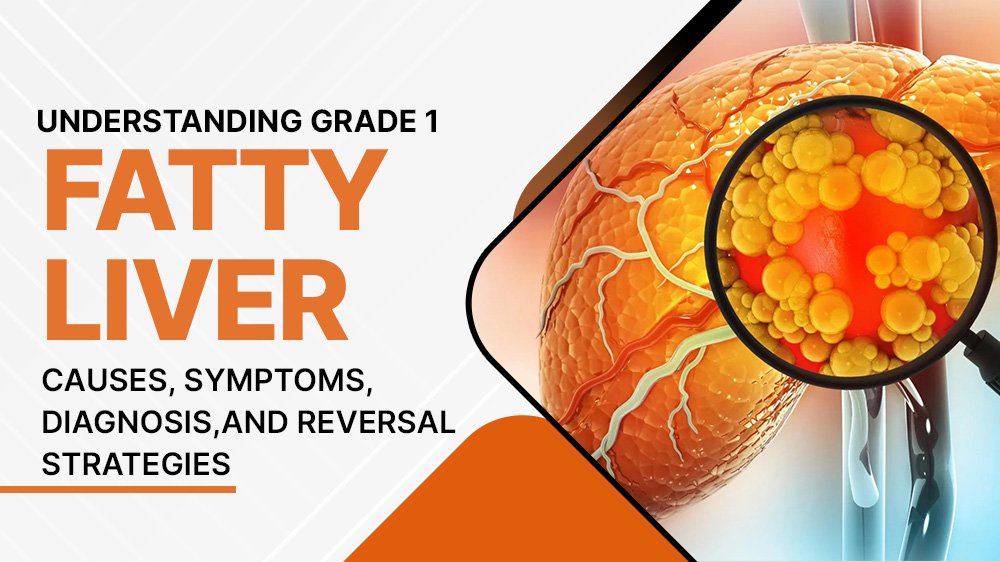 Understanding Grade 1 Fatty Liver: Causes, Symptoms, Diagnosis, and Reversal Strategies