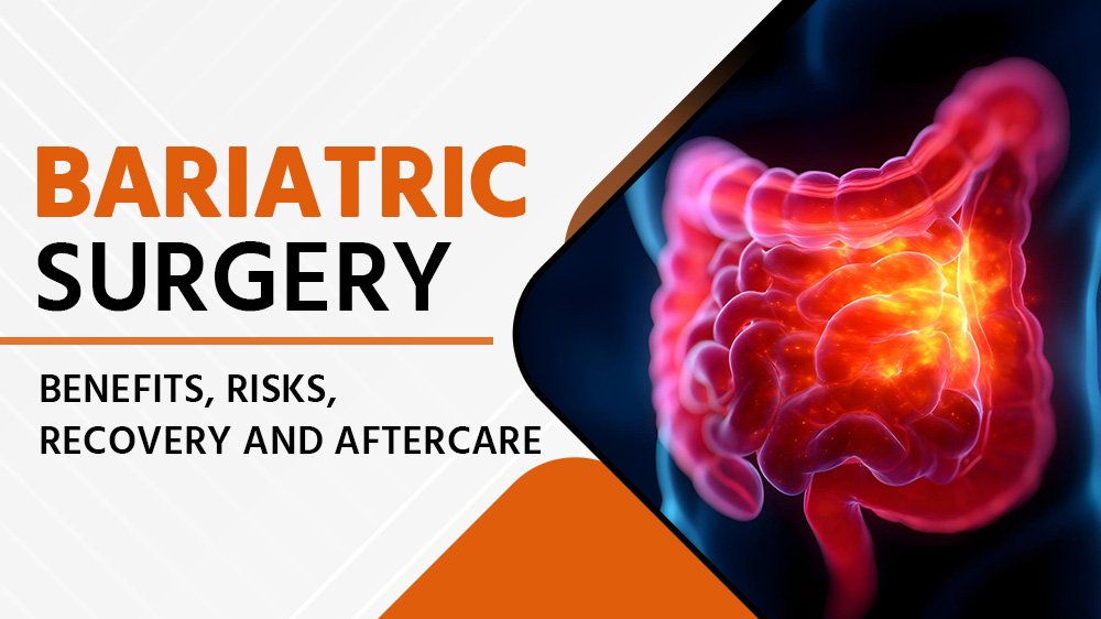 Bariatric Surgery: Procedures, Benefits, Risks, Recovery, and Aftercare