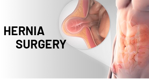 Hernia Surgery